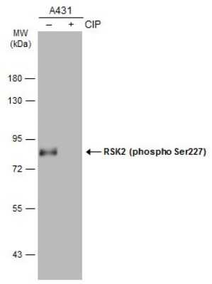 Western Blot: RSK2 [p Ser227] Antibody [NBP3-13244]